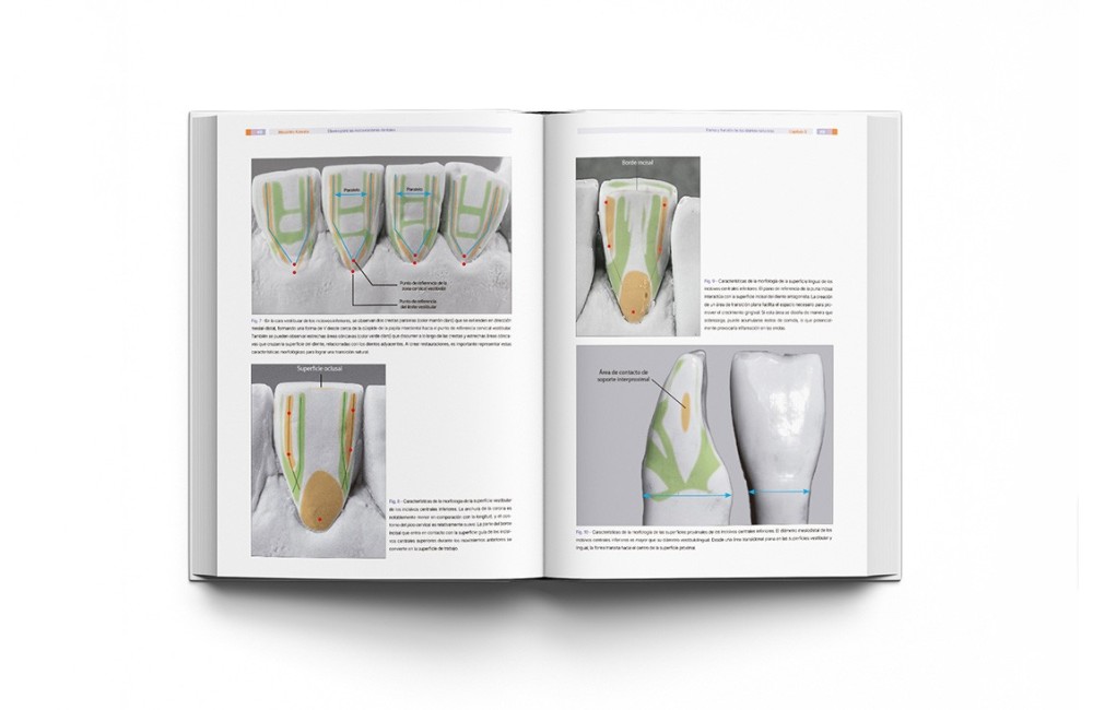 Implantología Dental de un Vistazo