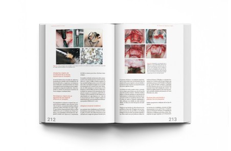 Implantología Dental de un Vistazo