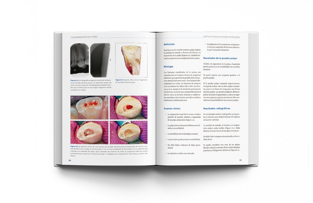 Traumatología Dental de un Vistazo