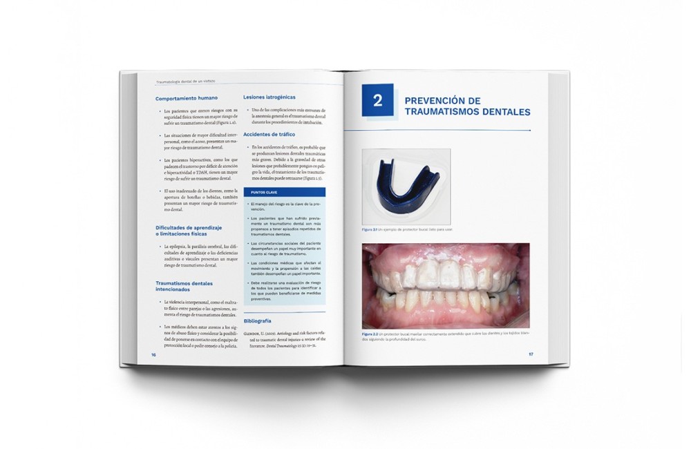 Traumatología Dental de un Vistazo