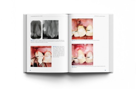 Traumatología Dental de un Vistazo