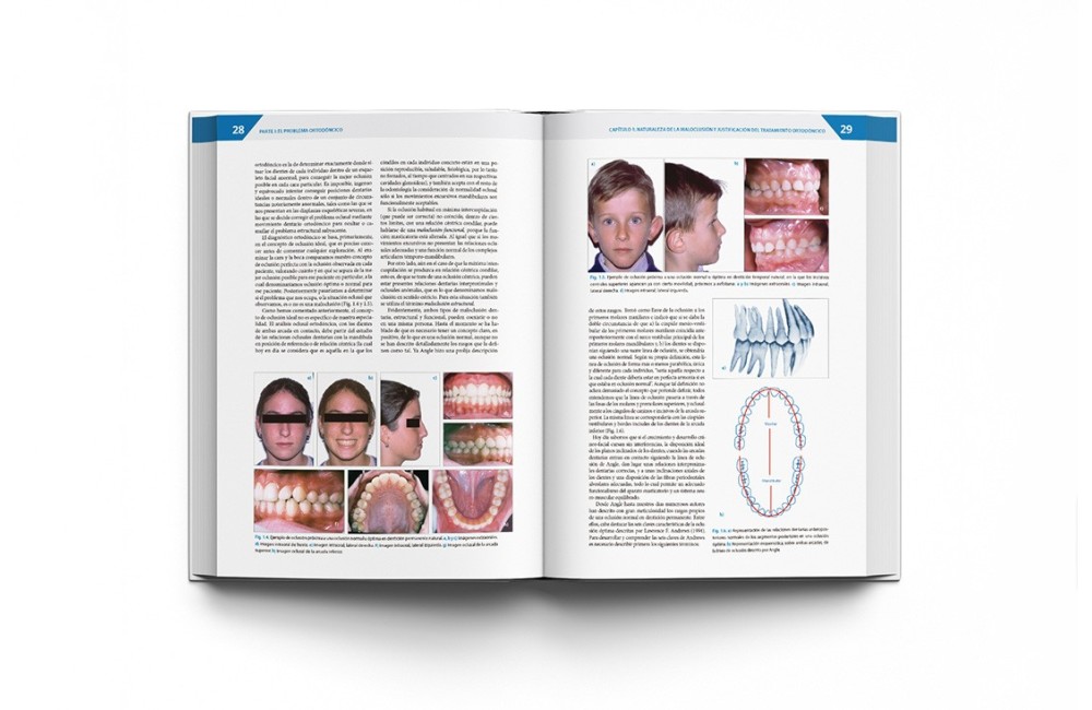 Teoría y Práctica de la Ortodoncia