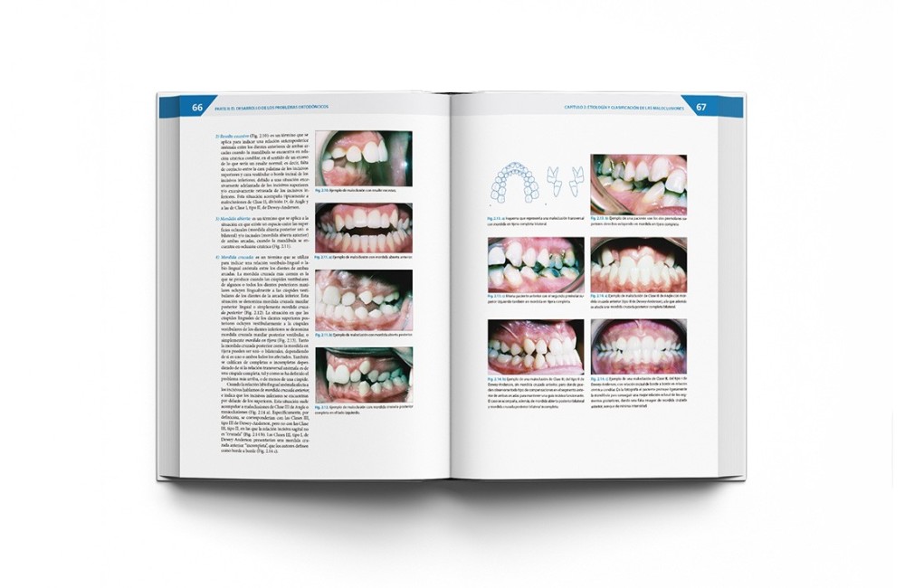Teoría y Práctica de la Ortodoncia