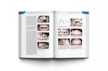 Teoría y Práctica de la Ortodoncia