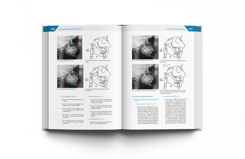 Teoría y Práctica de la Ortodoncia