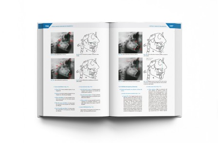Teoría y Práctica de la Ortodoncia