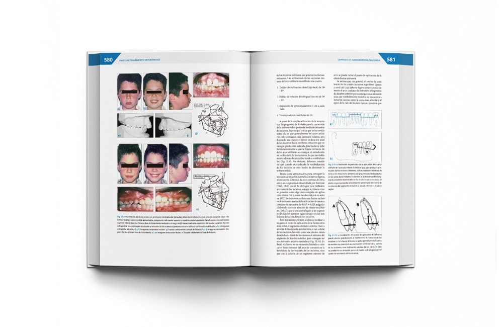 Teoría y Práctica de la Ortodoncia