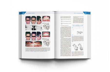 Teoría y Práctica de la Ortodoncia