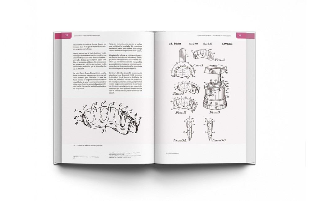 Ortodoncia Clínica con Alineadores