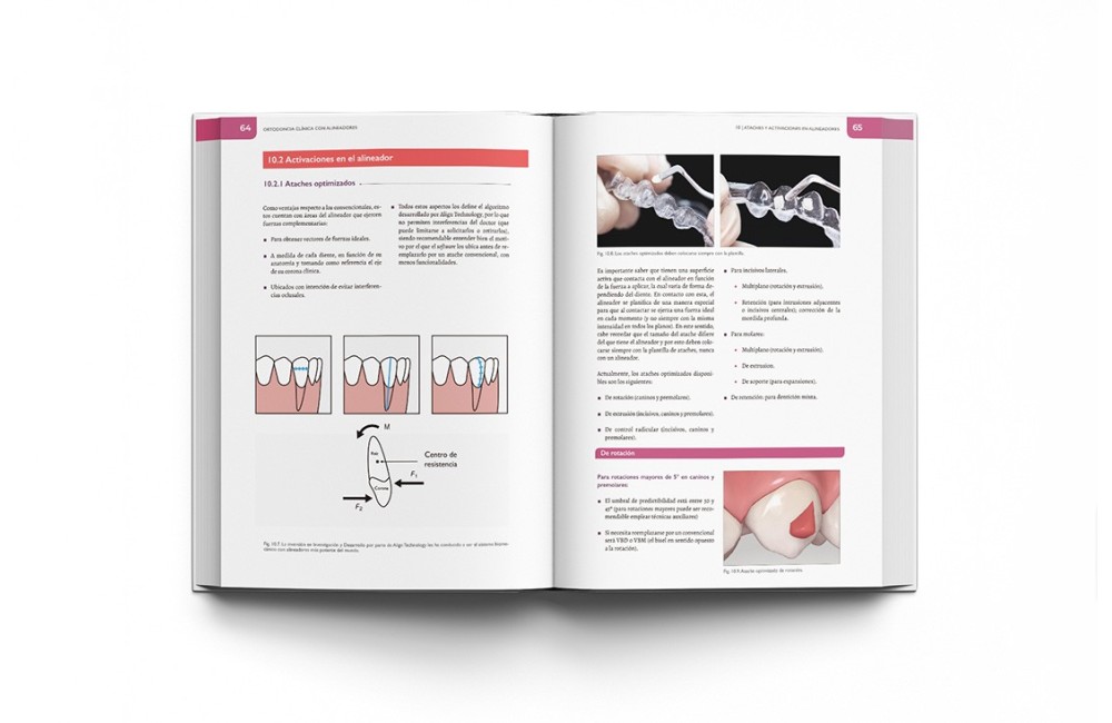 Ortodoncia Clínica con Alineadores