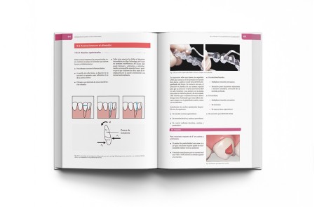 Ortodoncia Clínica con Alineadores