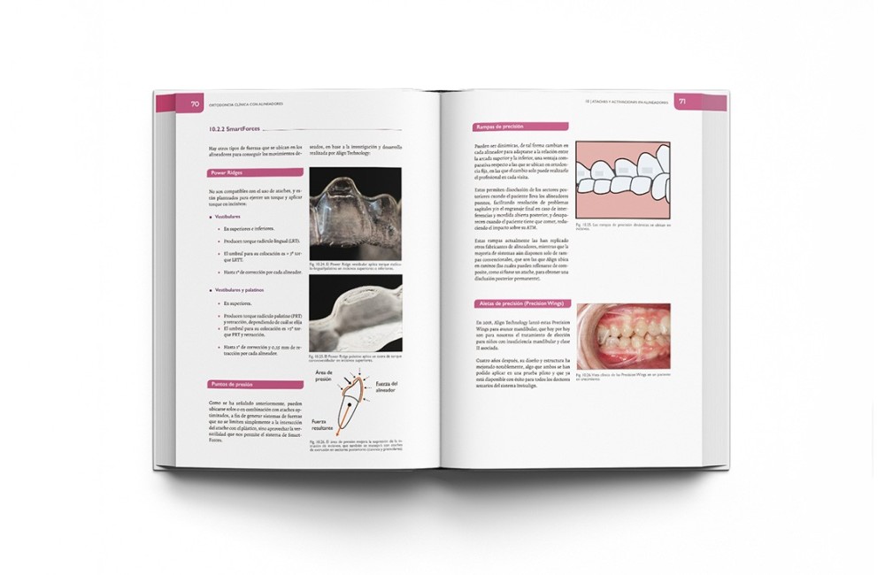 Ortodoncia Clínica con Alineadores