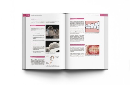 Ortodoncia Clínica con Alineadores