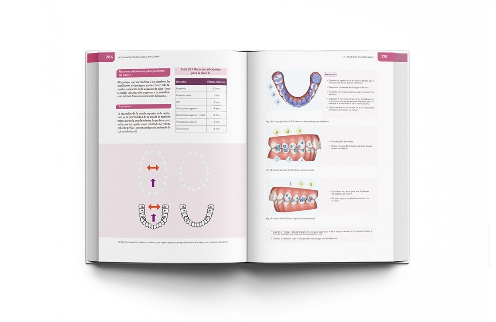 Ortodoncia Clínica con Alineadores