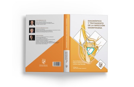Diagnóstico y Tratamiento de la Infección Odontógena