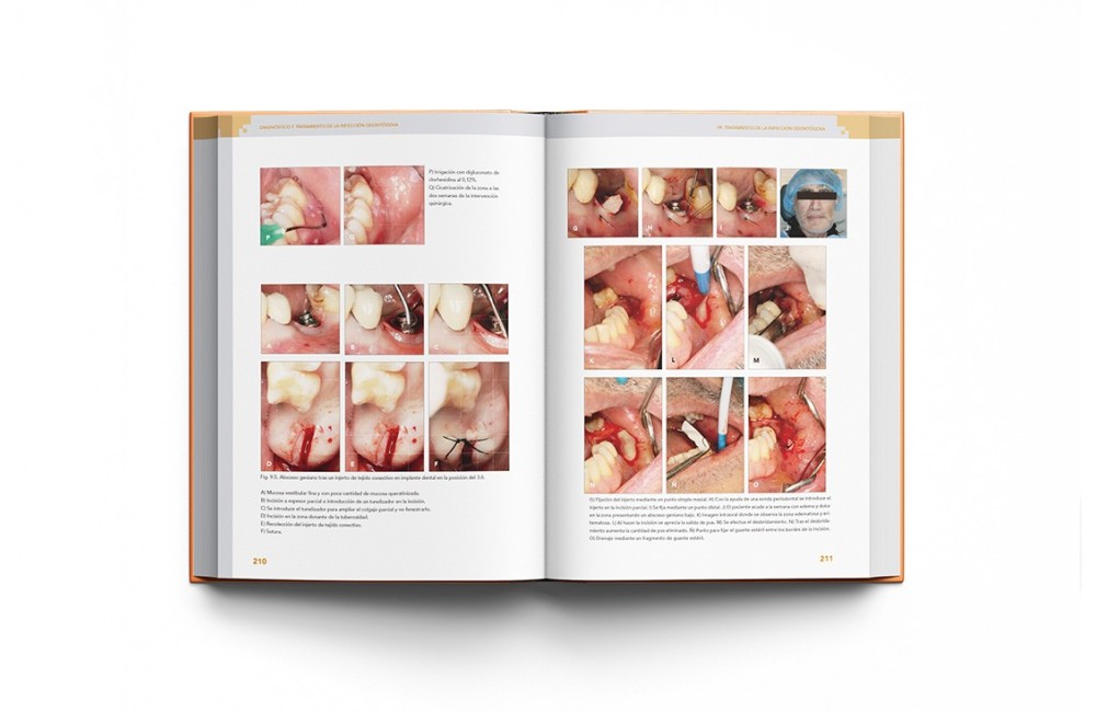 Diagnóstico y Tratamiento de la Infección...