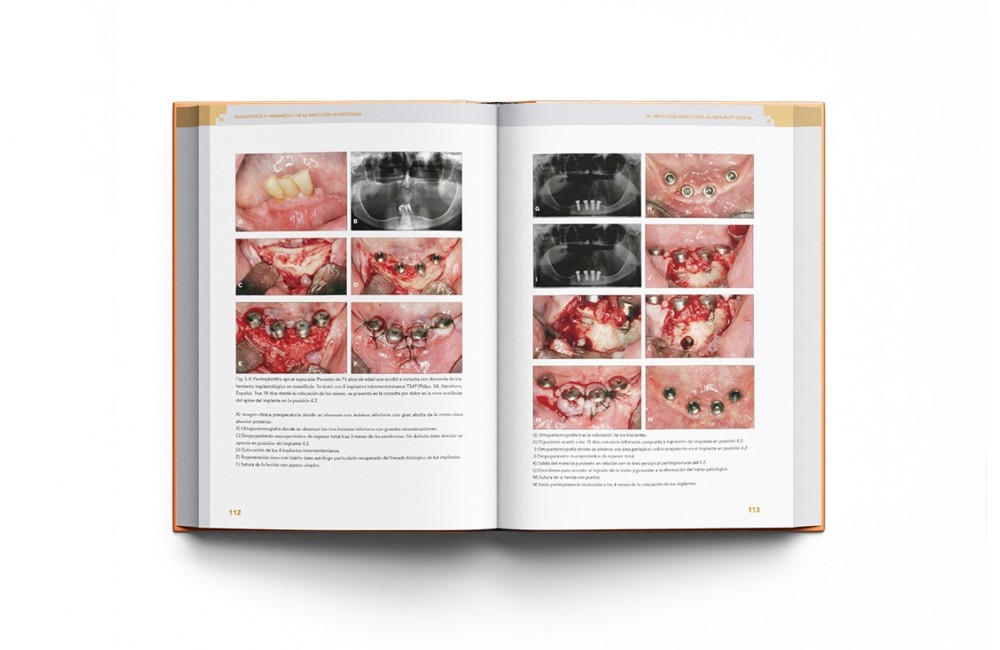 Diagnóstico y Tratamiento de la Infección...