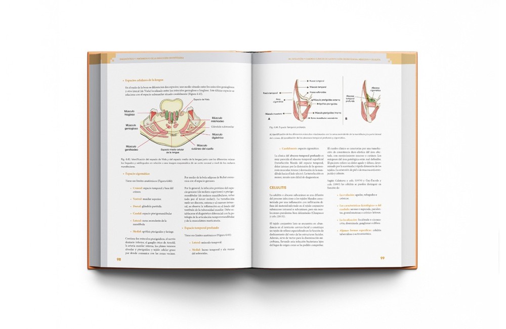Diagnóstico y Tratamiento de la Infección...
