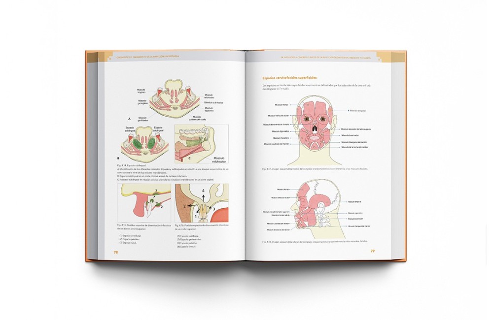 Diagnóstico y Tratamiento de la Infección...