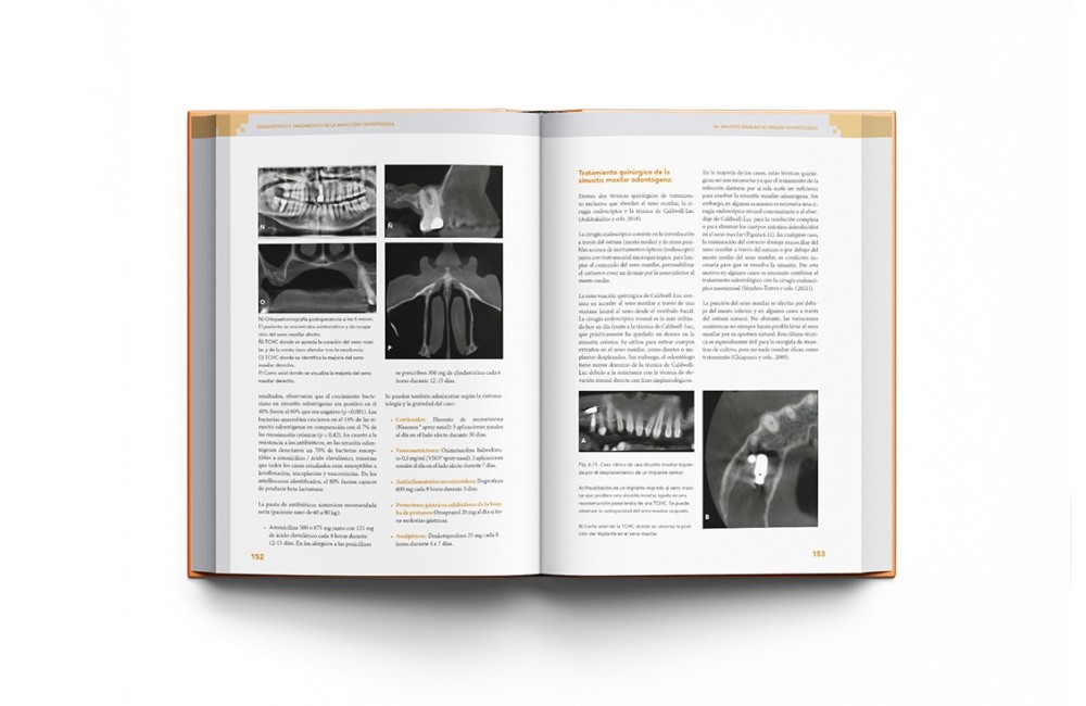Diagnóstico y Tratamiento de la Infección...