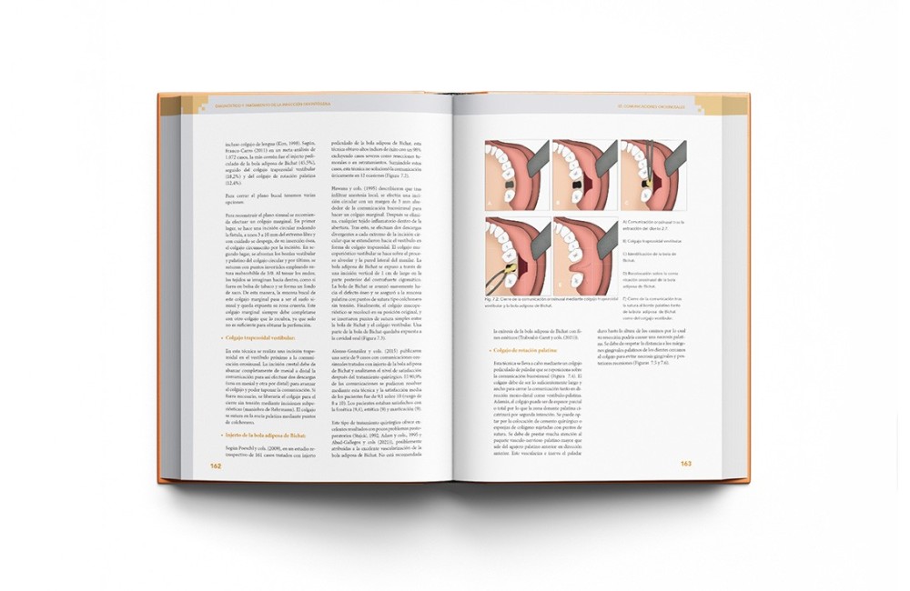 Diagnóstico y Tratamiento de la Infección...