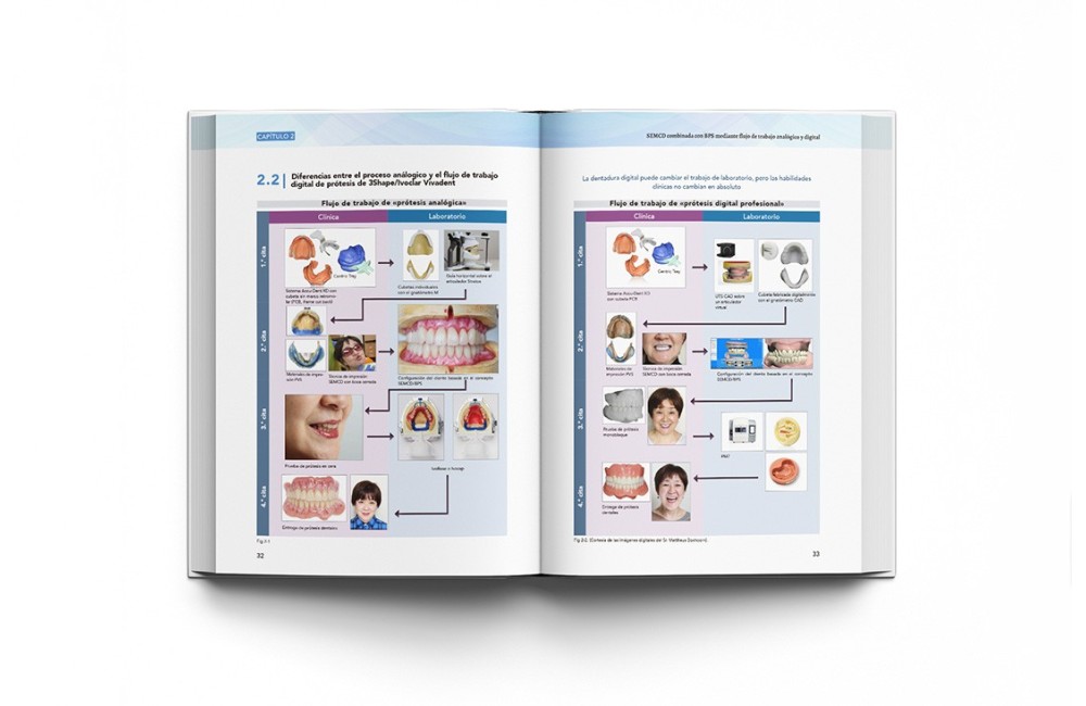 Prótesis Completa Mandibular con Técnica de...