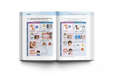 Prótesis Completa Mandibular con Técnica de Succión Efectiva