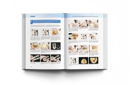 Prótesis Completa Mandibular con Técnica de Succión Efectiva