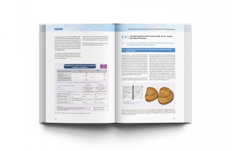 Prótesis Completa Mandibular con Técnica de Succión Efectiva