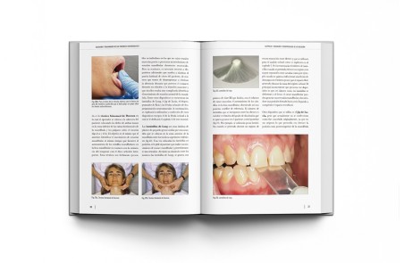 Oclusión y Tratamiento de los Pacientes con Desgastes 2 Volúmenes