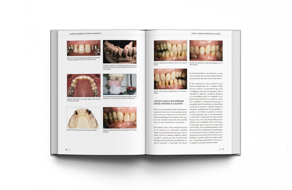Oclusión y Tratamiento de los Pacientes con...