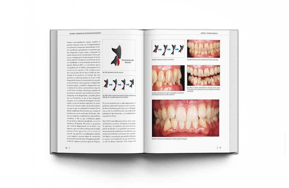 Oclusión y Tratamiento de los Pacientes con...