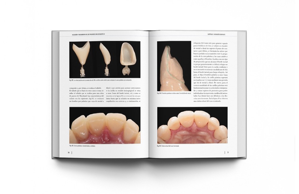 Oclusión y Tratamiento de los Pacientes con...