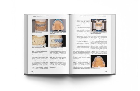 Oclusión y Tratamiento de los Pacientes con Desgastes 2 Volúmenes