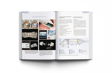 CAD-CAM en Odontología Digital