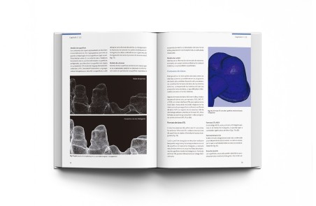CAD-CAM en Odontología Digital