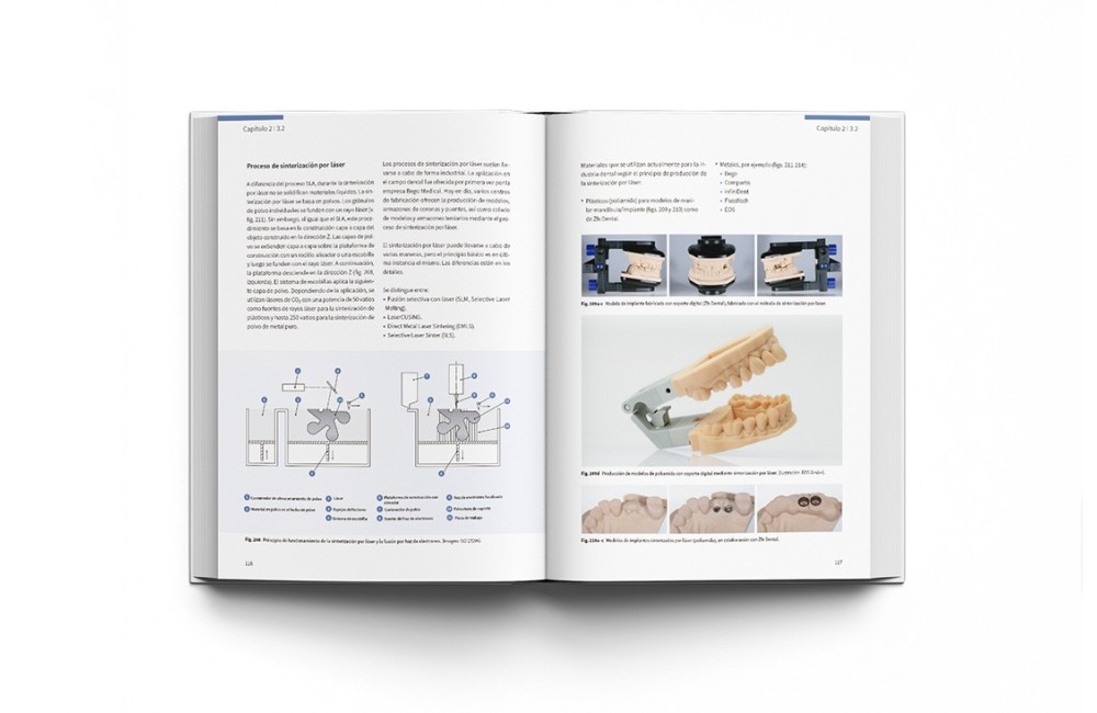 CAD-CAM en Odontología Digital