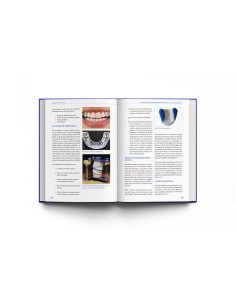 Bruxismo: Guía Clínica. Eduardo Padrós - Lisermed 2