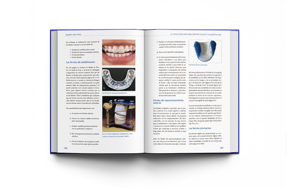 Bruxismo: Guía Clínica