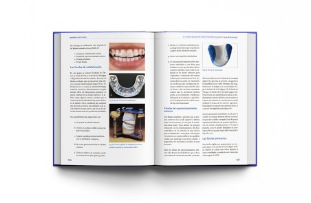 Bruxismo: Guía Clínica