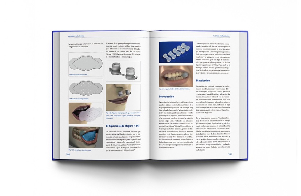 Bruxismo: Guía Clínica