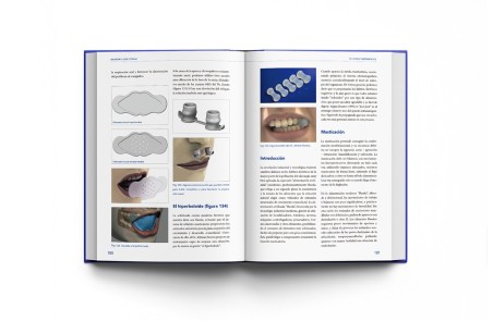 Bruxismo: Guía Clínica