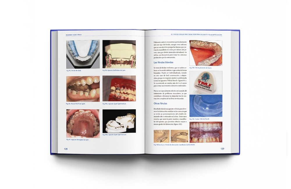 Bruxismo: Guía Clínica