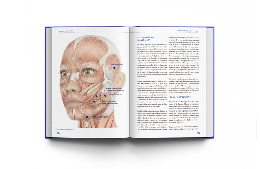 Bruxismo: Guía Clínica
