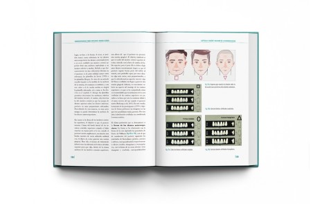 Sobredentaduras Sobre Implantes: Manual Clínico