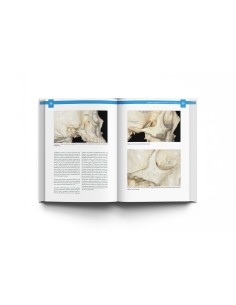 Atlas de Implantes Cigomáticos. Miguel Peñarrocha / Alberto Fernández / David Peñarrocha - Lisermed 2