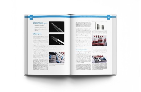 Atlas de Implantes Cigomáticos