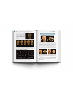 La Guía Definitiva para la Morfología Dental. Daiyu Wakita - Lisermed 2