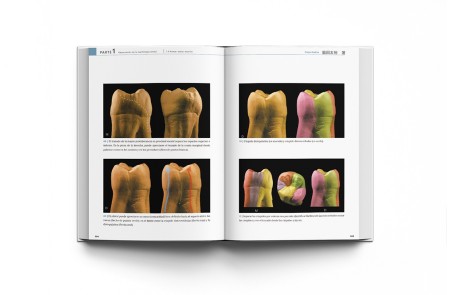 La Guía Definitiva para la Morfología Dental. Morfología de los Dientes Naturales 1