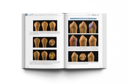 La Guía Definitiva para la Morfología Dental. Morfología de los Dientes Naturales 1